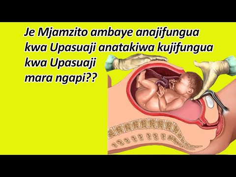 Video: Kwa nini upasuaji wa upasuaji ni bora zaidi?