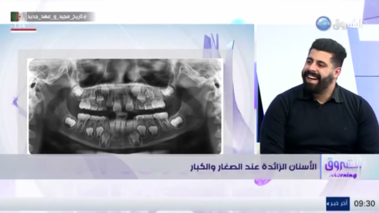 الأسنان الزائدة عند الصغار والكبار