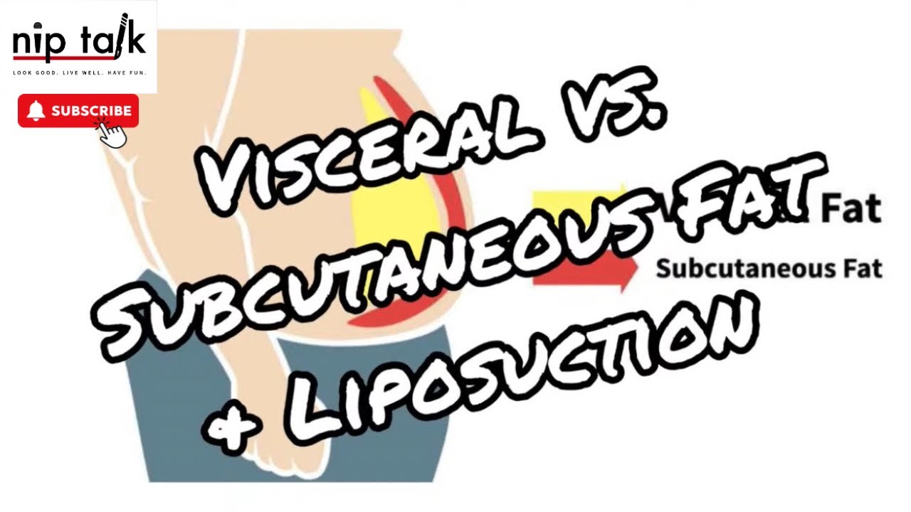 Visceral vs Subcutaneous Fat  What does that mean for Liposuction?