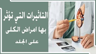 التاثيرات التي تؤثر بها امراض الكلى على الجلد