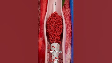 Removing Blood Clots with Vacuum😳#shorts #viral