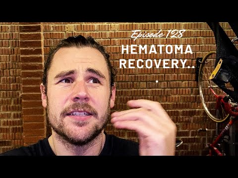 Video: Vai hematomas pāriet pašas no sevis?