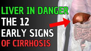 12 Shocking Signs of Liver Disease You Might Have Right Now