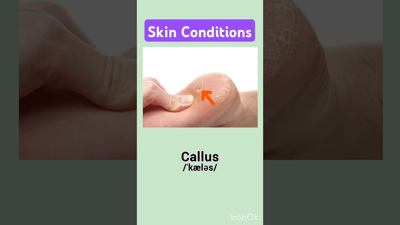 Skin conditions ? #learnenglish #dailyenglish #vocabulary #learn #vocabulary#quiz