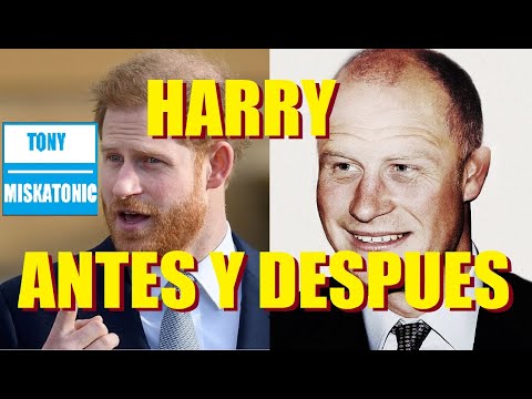 Vídeo: El príncep Harry va ser vist a la clínica de trasplantament de cabell