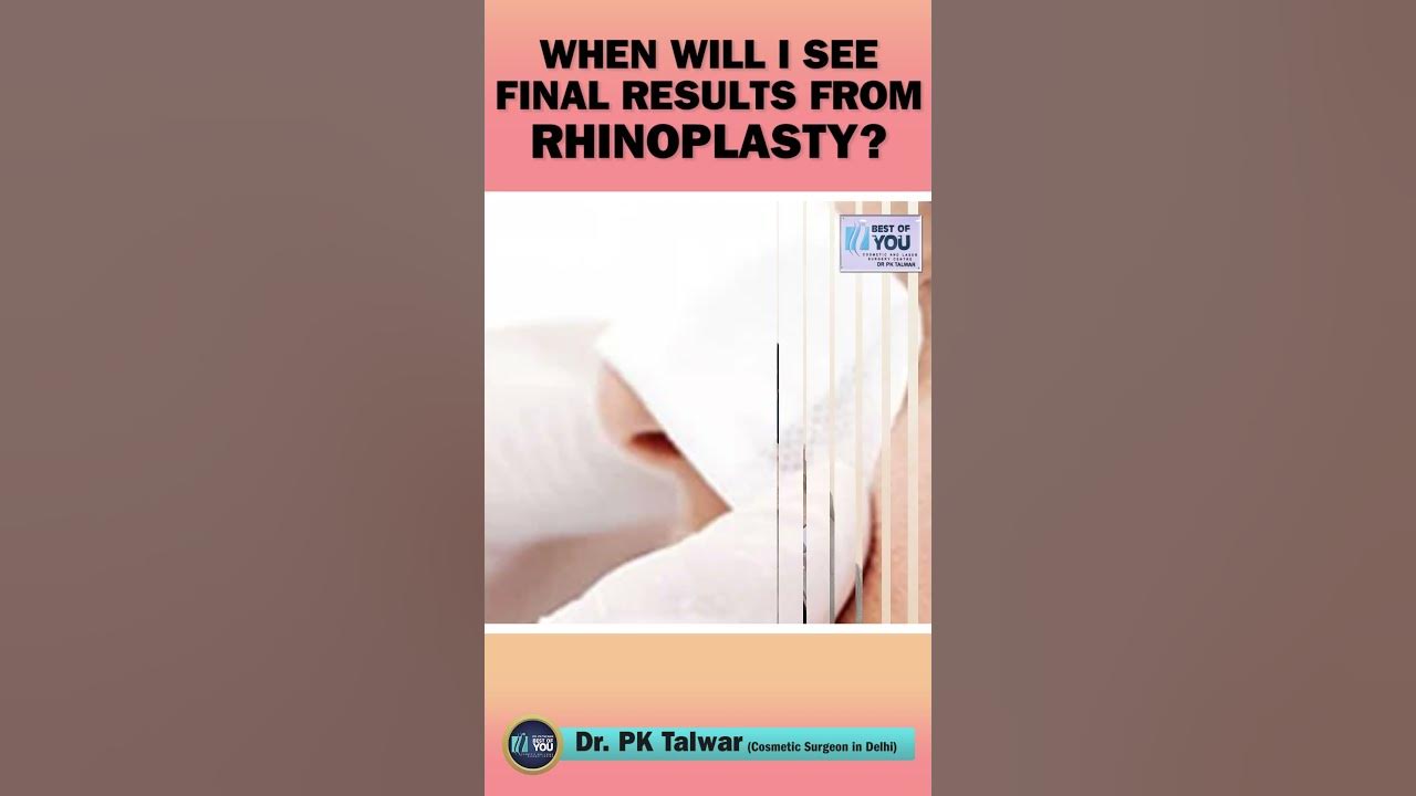 how-long-after-rhinoplasty-can-you-see-final-results-nose-job-surgery