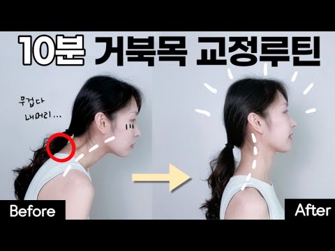 딱 10분! 거북목, 버섯증후군이 있다면 이 운동 제발 하셔야 합니다! 일자목, 거북목 스트레칭, 버섯증후군교정운동