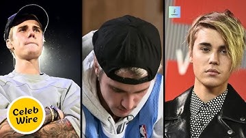 Justin Bieber’s Shocking Confession—Struggles with Self Doubt!