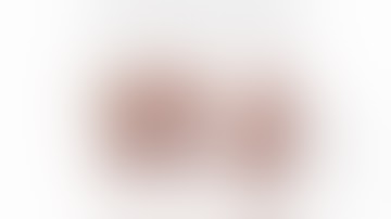 Standardized Five Steps for Robotic Left Upper Lobectomy Using Robotic Stapler