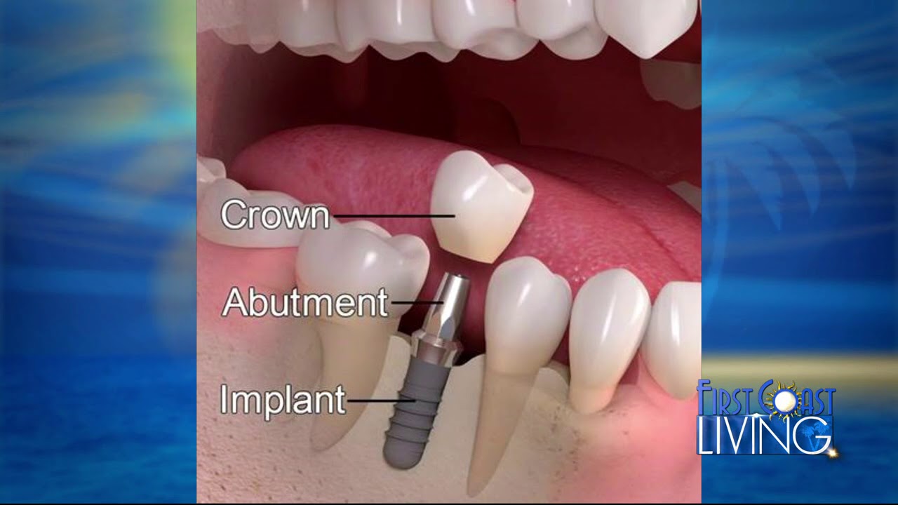 FCL Monday May 21st Jacksonville Dental Specialists