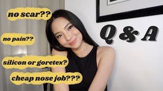 ✨answering Rhinoplasty (Nose Job) in Philippines FAQs NEED TO KNOW | @AlissaTen