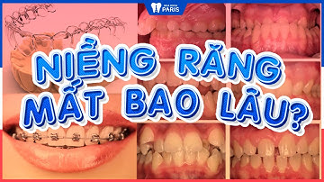 Thời gian niềng răng mất bao lâu?