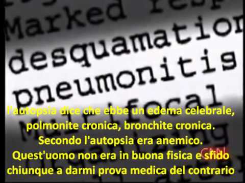 Sta uscendo scansione o LMP più accurata
