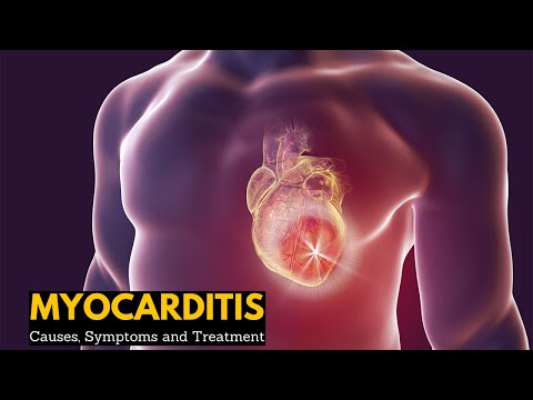 Myocarditis, Causes, Signs and Symptoms, Diagnosis, Treatment