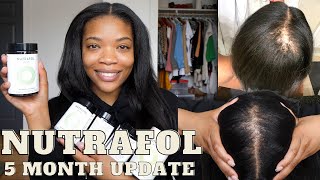 Nutrafol 5 Month Update #Nutrafol #hairgrowth #alopecia