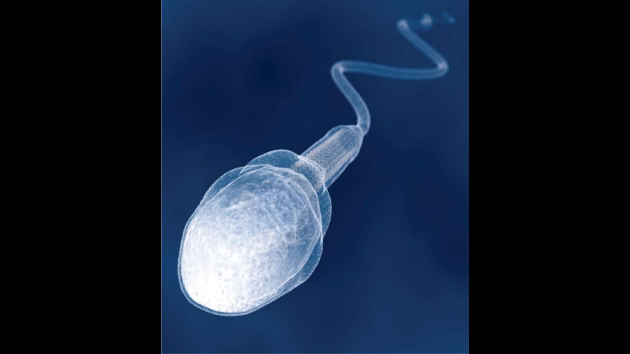 Azoospermia new test and treatment YouTube