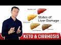 Why a Fatty Keto (Ketogenic) Diet Can Reverse a Fatty Liver