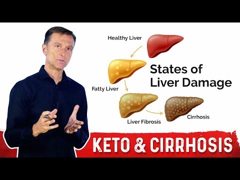 Why a Fatty Keto (Ketogenic) Diet Can Reverse a Fatty Liver