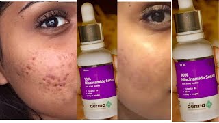 Derma Co. Niacinamide Serum MY HONESST REVIEW THE TRUTH | DUPE OFODINARY@THE DERMA CO.BUYING OR NOT