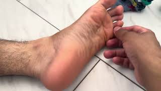 After sweaty walk feet