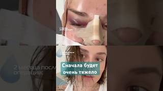 Процесс реабилитации после пластики