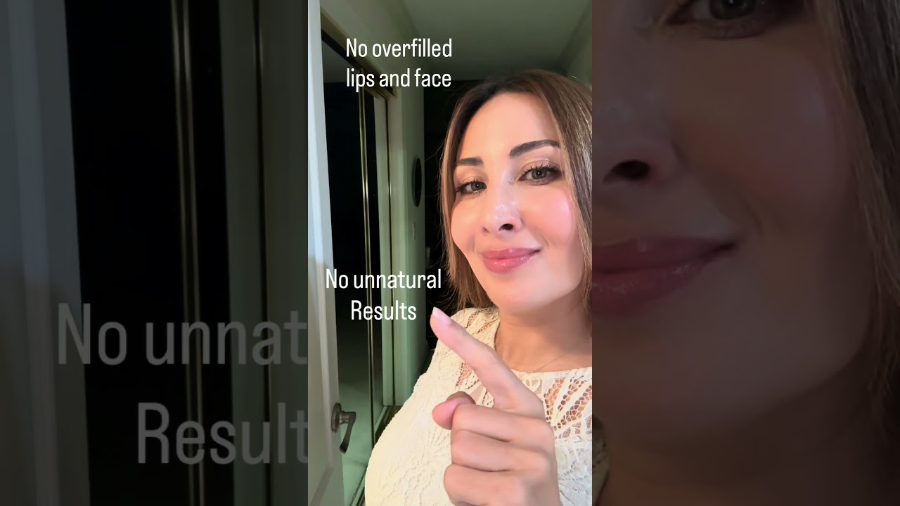 Natural results at Viva MD Aesthetics 