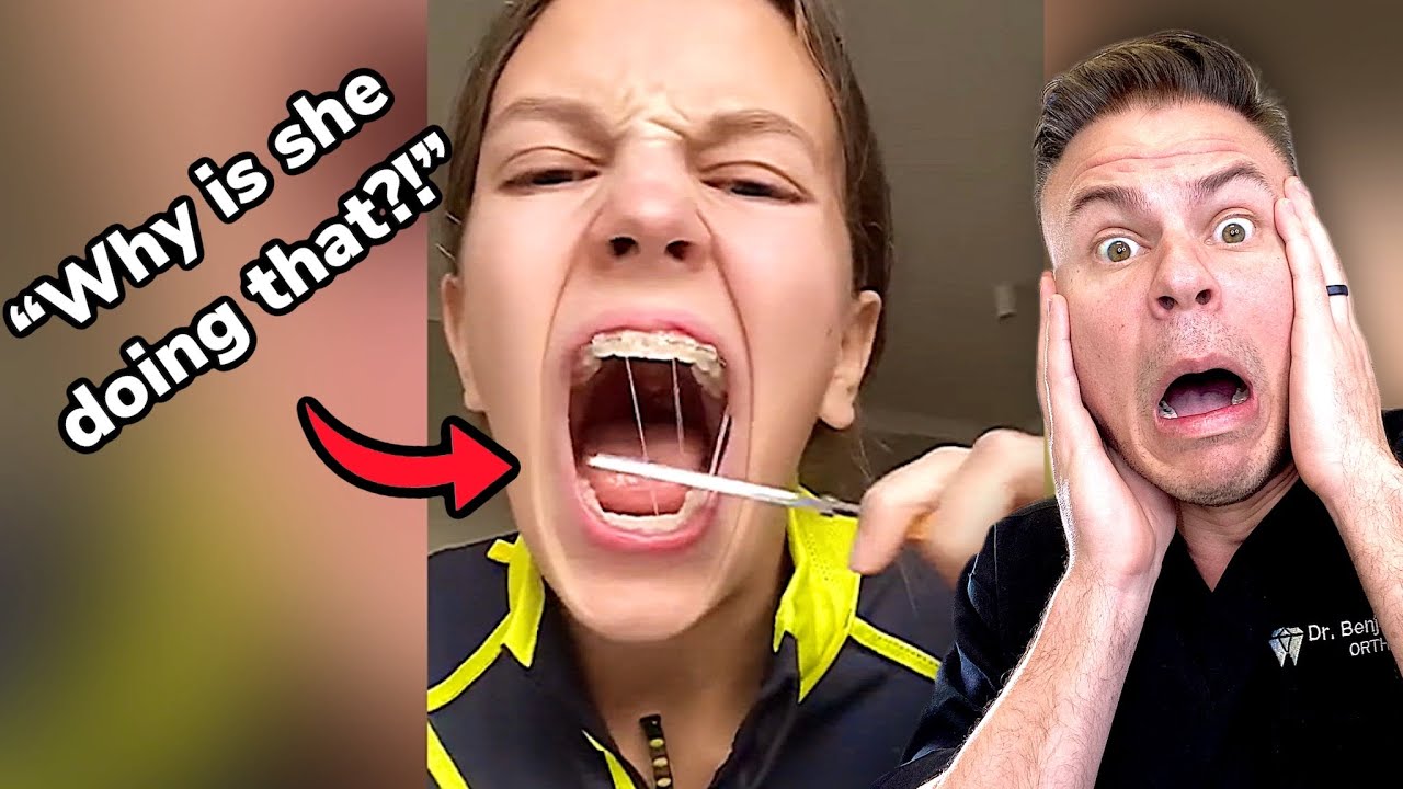 ⁣When You Don’t Know How To Use Braces.. Orthodontist Reacts!