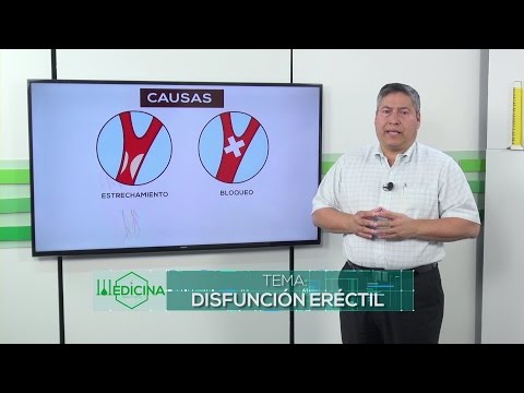 Vídeo: ¿Puede Un Anillo De Disfunción Eréctil Tratar La Impotencia?