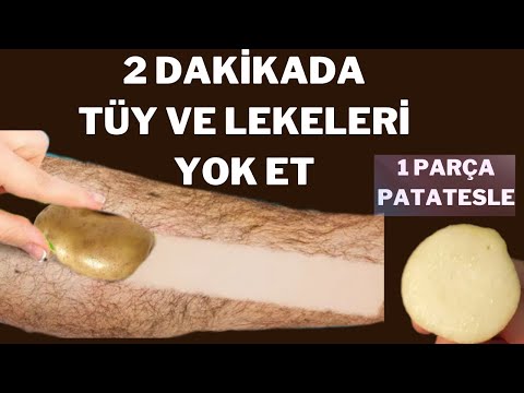 1 parça patatesle 2 dakikada kıl tüy cilt lekeleri vücut kararmalarından kurtuldum patates maskesi