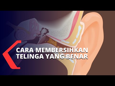 Ini Cara Membersihkan Telinga yang Baik dan Benar