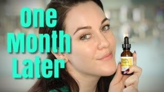 Kommuner Bemyndige komponent MAD HIPPIE VITAMIN C SERUM...ONE MONTH LATER!🍊📆💎 - YouTube