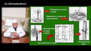 Часть 2 Операции на сосудах конечностей. Проф. Ахмадудинов М.Г.