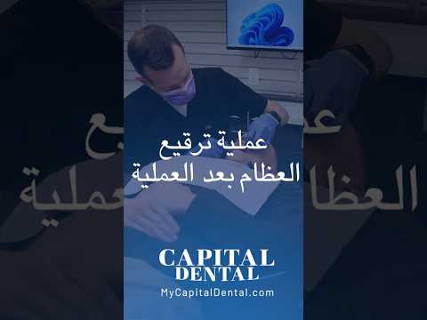      إرشادات بعد عملية ترقيع العظام