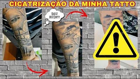 Como ocorre o processo inflamatório da tatuagem?
