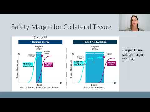 State Of The Art Pulsed Field AF Ablation