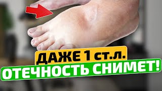 Старый доктор спас меня этим советом! Как избавиться от отеков ног.