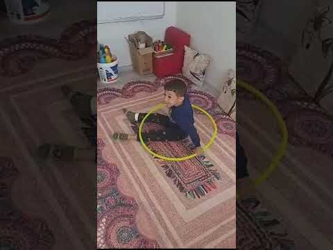 Alçılı ayak ile
