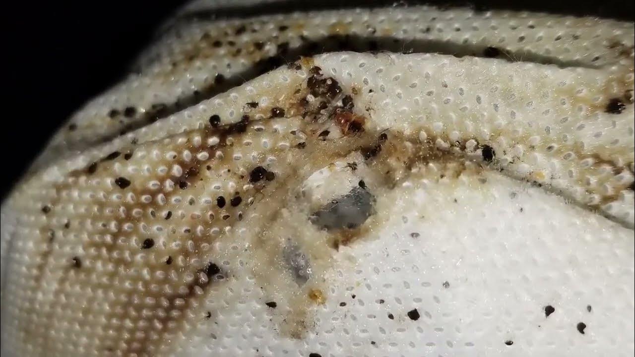 THE WORST BED BUGS EVER PART 2 REAL LIFE VIDEO AND PICTURES YouTube