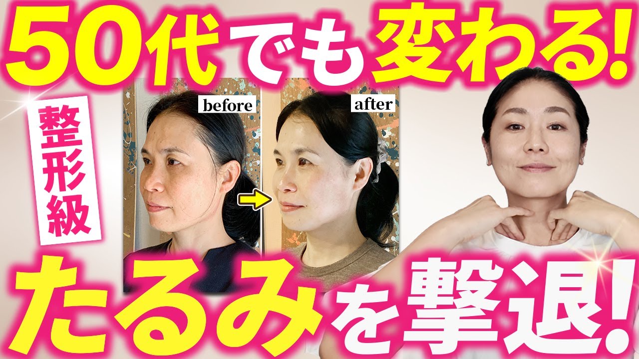 5分整形級！【たるみ撃退にはここ！】50代でもここまで変わる