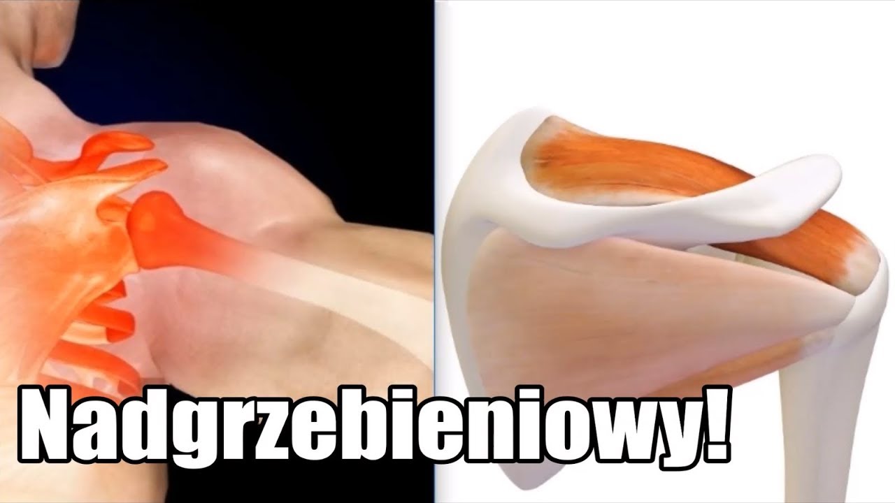 Mięsień nadgrzebieniowy [Ból barku, przeTESTuj się!] Zapomniane mięśnie #4