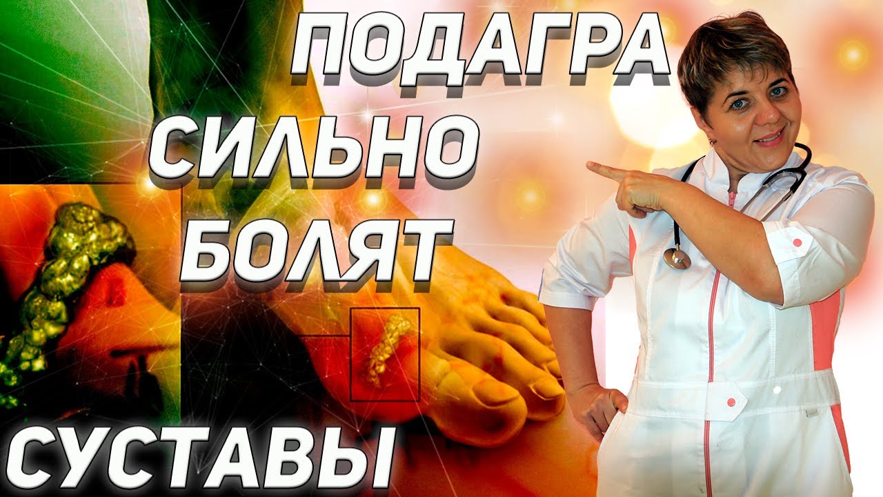💊 ПОДАГРА, сильно болят суставы 🔴 диета и лечение 💚 Как правильно ...