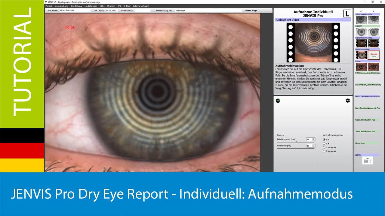 Jenvis Report.pdf JENVIS Pro Dry Eye Report - Individuell: Beurteilungsmodus - YouTube
