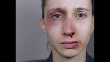 Reversing the Trend | UNFPA x Randistic