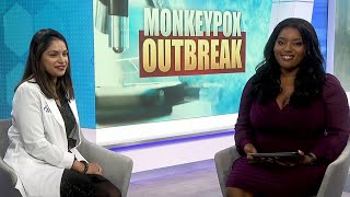 Monkeypox investigations in U.S.
