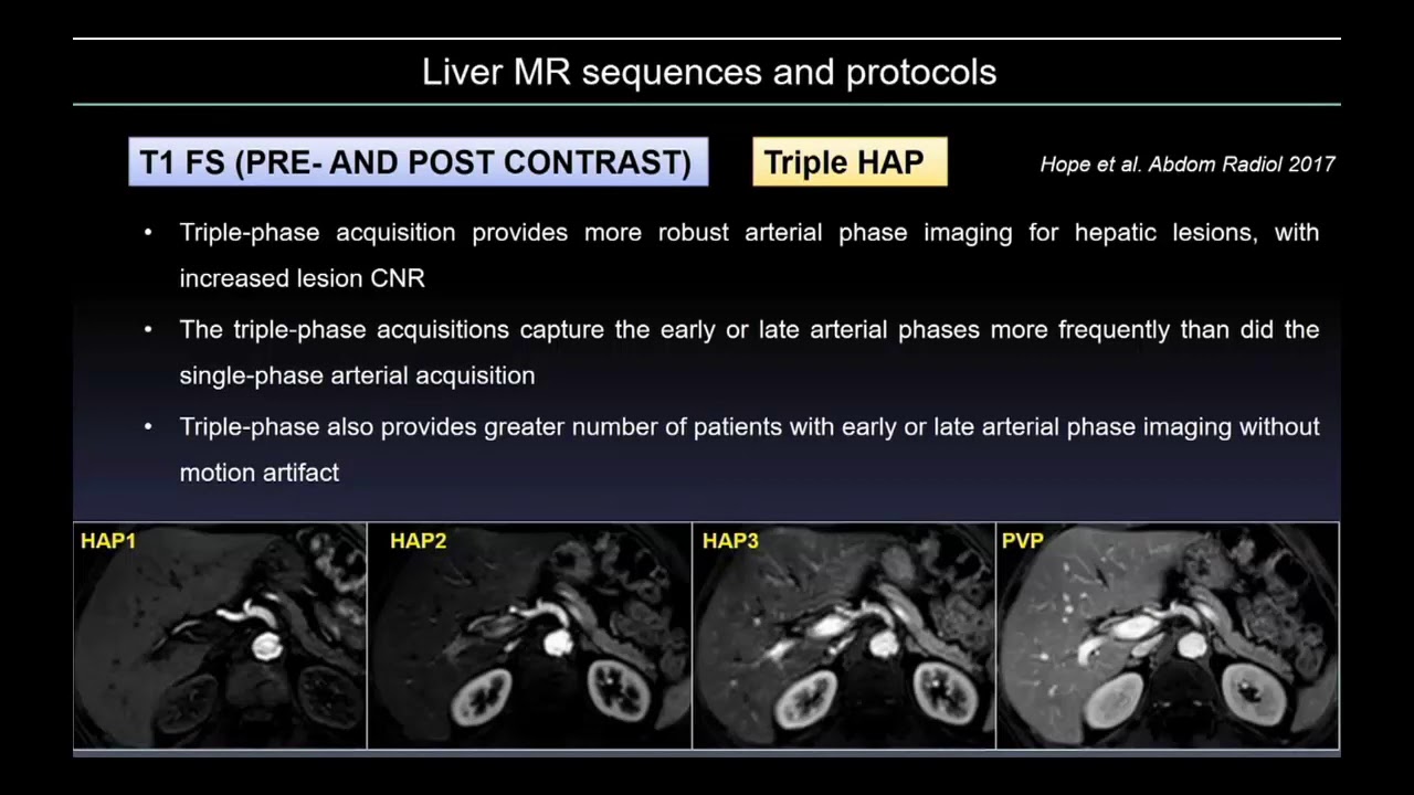 protocolos rm higado