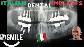 Italian Dental Implants, Panoramic X-ray by Very Nice Smile Dental 1,102 views 1 year ago 13 minutes, 8 seconds