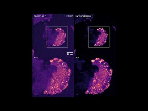 ZeroCostDL4Mic Video #9