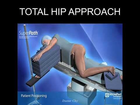 Direct superior portal assisted approach for total Hip approach