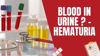 Blood In Urine - Hematuria