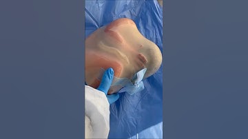 Thumbnail of Birth/Nascita of a silicon baby in the womb#baby#babieslife#kids#babyborn#trending#viral#babies#baby